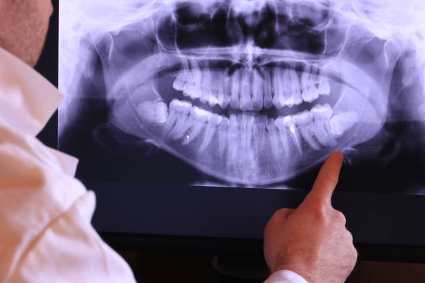 Best Emergency Root Canal Treatment in Melwood, MD